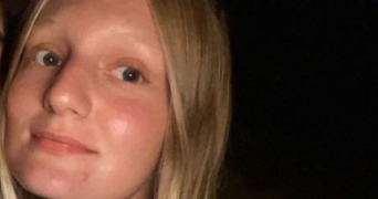 maëlys pet sitter à VERSON 14790_0