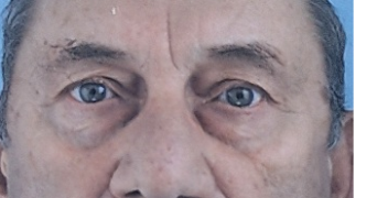 jacques pet sitter à VENANSAULT 85190_0